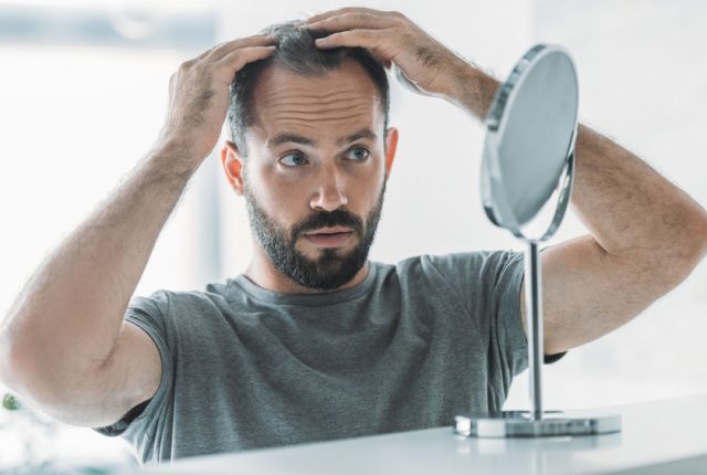 Is Baldness a Result of Low Testosterone?